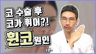 코수술은 한번에 끝낼수 없는 이유? 코재수술은 필수? 1편 코수술 후 코가 휘어서, 무조건 코가 휜다 (휜코)