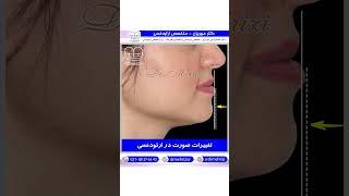 تغییرات صورت در ارتودنسی | دکتر احسان ابویی مهریزی