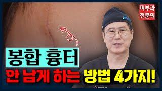 수술흉터 봉합흉터 없애고 싶다면 3가지만 기억하세요! | 봉합 수술 흉터 레이저 제거 치료