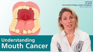 Mouth Cancer | Recognising symptoms, risk factors, and post-treatment dental care