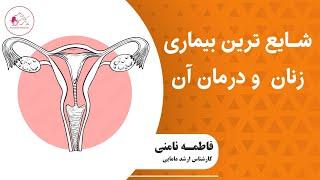 شایع‌ ترین بیماری زنان چیه و چطور درمان میشه؟؟