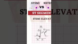 STEMI  vs NSTEMI   #medico #shortsvideo #shorts #nursing #stemi #nstemi