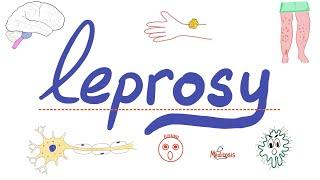 Leprosy (Hansen Disease) - Mycobacterium leprae - Microbiology  & Infectious Diseases