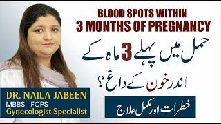 Blood Spot in Early Pregnancy: 3rd Month Of Pregnancy | Bleeding in Pregnancy Urdu | Khoon Ka Ana