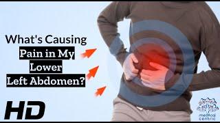 Abdominal Ailments: Common Triggers of Lower Left Pain Explained