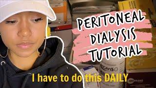 My Daily Peritoneal Dialysis | TUTORIAL (Amia Machine)