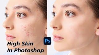 High End Skin Retouch with Dodge & Burn in Photoshop l Retouch4me