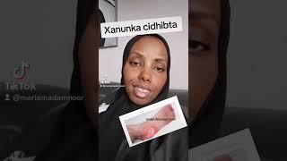 xanunka ciribta/cidhibta