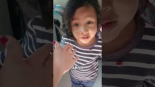 Reaksi Mama Ara Liat Hidung Bagas Berdarah Mimisan. Mama Cari Daun Sirih Buat Mampetin Darahnya Ya 
