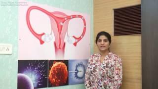 IVF Treatment Process Explained In Brief - Dr Neeraj Pahlajani