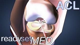 What is an Allograft Surgery? - ACL Series