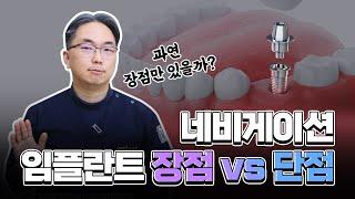 네비게이션 임플란트 장점 vs 단점