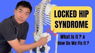 Is It Locked Hip Syndrome? And How Do We Fix It?