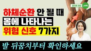 하체순환이 막히고 있다는 SOS 내몸 신호. 다리혈액순환 안 될때 증상 [정라레]