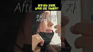 비절개코수술, 납작코에도 효과 있을까? #shorts #코성형후기 #코젤코