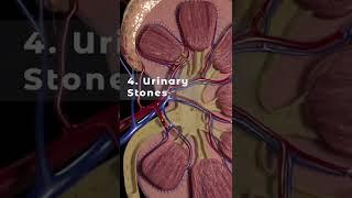 UTI in men and its causes
