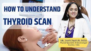 Understand Thyroid Scan - Dr.Tanvi Mayur Patel