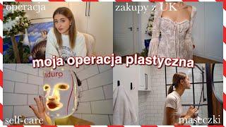 VLOGMAS 10 moja pierwsza operacja plastyczna… *pogadajmy*