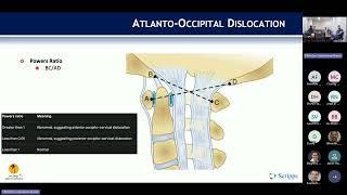 Occipitocervical Trauma : Gautham Prabhakar, MD on September 23, 2024.