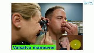 Valsalva maneuver