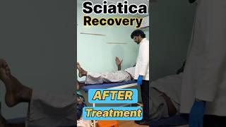 Sciatica Recovery After Treatment #treatment #hospital #karnataka  #trending #yt #ytshort #india