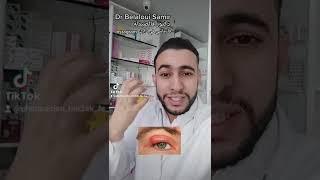 Dr Belaloui Samir : Orgelet ou chalazion الشعيرة