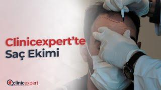 Clinicexpert Dhi saç ekimi hastanede ortamında nasıl yapılır?