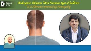 Baldness|Androgenic Alopecia|Alternative Treatment by Homeopathy -Dr.Sanjay Panicker|Doctors' Circle