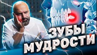 ПОЧЕМУ БОЛИТ ЗУБ МУДРОСТИ?! ВСЁ О ЗУБАХ МУДРОСТИ. Доктор Рауль