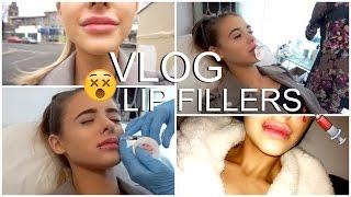 VLOG: LIP FILLERS & A DAY IN THE LIFE