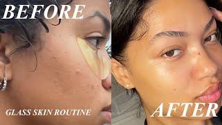 How To ACTUALLY Get Rid Of Small Bumps and TEXTURE! Routine for Closed Comedones | Nia Kajumulo