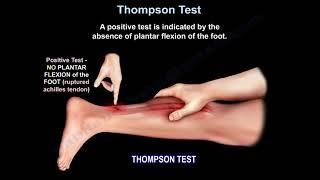 Thompson Test  Achilles tendon tear