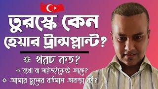 Hair transplant in Turkey, But Why? || তুরস্কে হেয়ার ট্রান্সপ্লান্টে খরচ কত? || Any Side Effects?