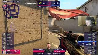 S1mple scoping with lightspeed | CSGO