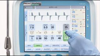 fabian HFO: SIPPV Synchronized Intermittent Positive Pressure Ventilation