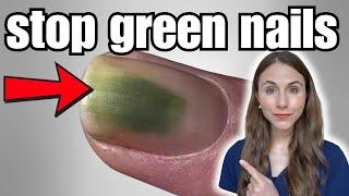 How To Stop Green Nails After Press Ons