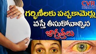 How to Control Jaundice In Pregnancy Period | Pregnancy Tips | Dr. Surya Rao | CVR Health