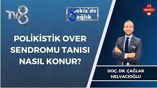 Polikistik Over Sendromu Tanısı Nasıl Konur? | Doç. Dr. Çağlar Helvacıoğlu | 8'de Sağlık