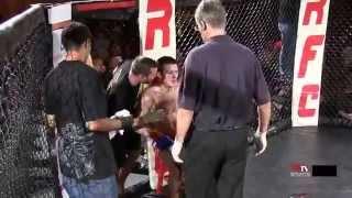 RFC 31 Matthew Ferraiolo VS Tony Leone