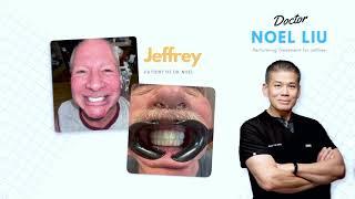 From Collapsed Bite to Confident Smile: Fixed Full Arch Journey | Dr. Noel Liu | Secure Dental