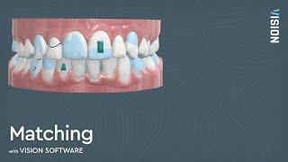 Matching in Clear Aligner Treatment Planning