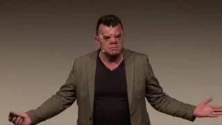 Own your face | Robert Hoge | TEDxSouthBank