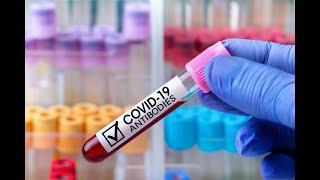 IgM and IgG antibodies represent different stages of an immune response against COVID-19