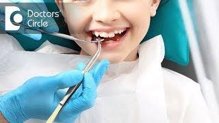 Are there any ways to prevent Dental Caries? - Dr. Manesh Chandra Sharma