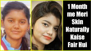 Get Your Real Complexion Back Naturally | My Story | #AnchalShukla