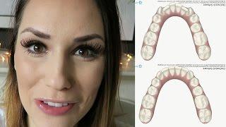 ICH BEKOMME EINE ZAHNSPANGE?! | WEISHEITSZAHN OP | INVISALIGN VIDEO DEUTSCH || KathisFinest