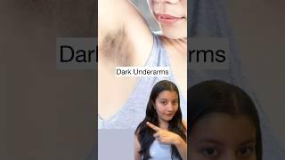 Watch This If You Have DARK Underarms
