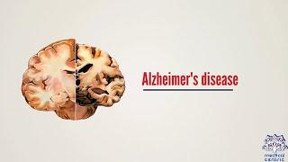 What is Alzheimer's disease? Causes, Signs and Symptoms, Diagnosis and Treatment.