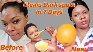 You will never wear make-up again/ How to clear dark spots, glow and look YOUNGER #acne #diy