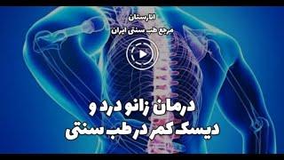 درمان زانو درد و دیسک کمر با طب سنتی | راهکارهای گیاهی و طب سوزنی موثر